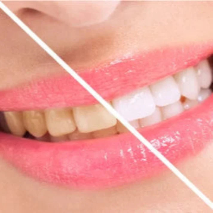 👑LAST DAY UP TO 70% off:Insideefy ™ smiles new upgraded automatic self-brushing toothbrush