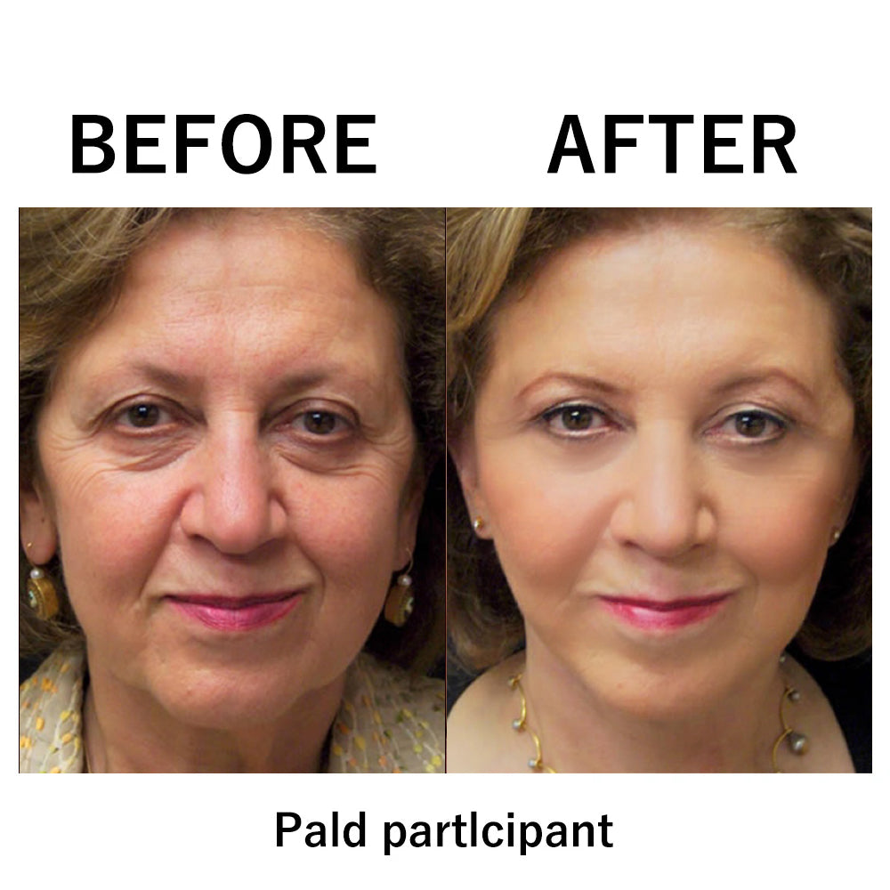 🔥 Last Day Discount: 80% OFF 🌸Instant Temporary Face Tightener