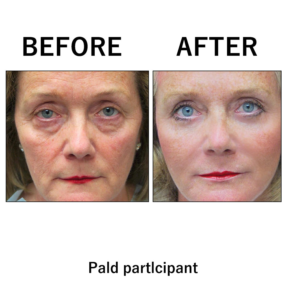 🔥 Last Day Discount: 80% OFF 🌸Instant Temporary Face Tightener
