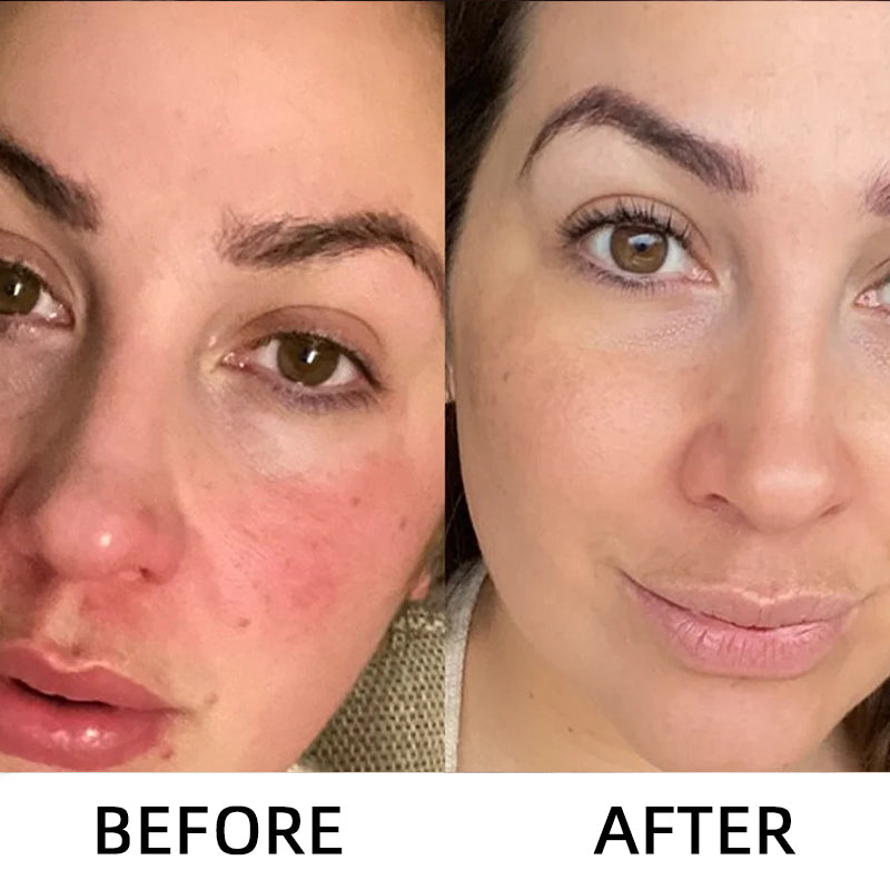 🎉 75% OFF Today-Peel Shot Glow Rice Ampoule Set Brightening Exfoliating Moisturizing Serum - 💧 For All Types