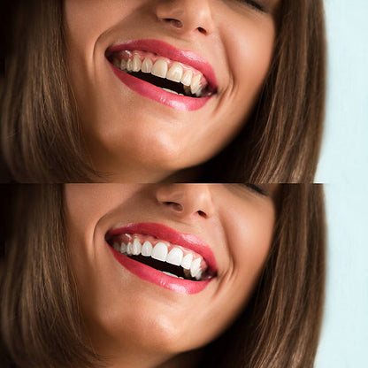 🔥60% OFF LOVILDS™ Remove yellow stains, whiten teeth, achieve quick whiteness. One-time whitening tooth patch for fast tooth whitening.